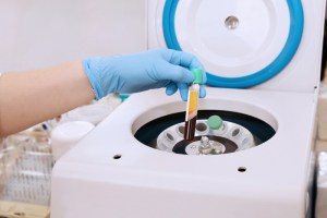  Advanced Platelet Rich Fibrin technology